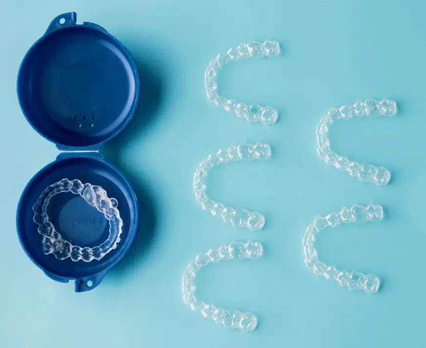 advantages of invisalign in brentwood - hallmark dental brentwood