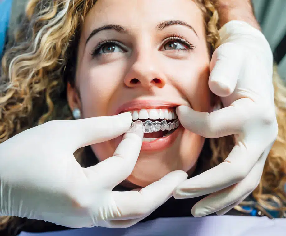invisalign dentist brentwood - hallmark dental brentwood