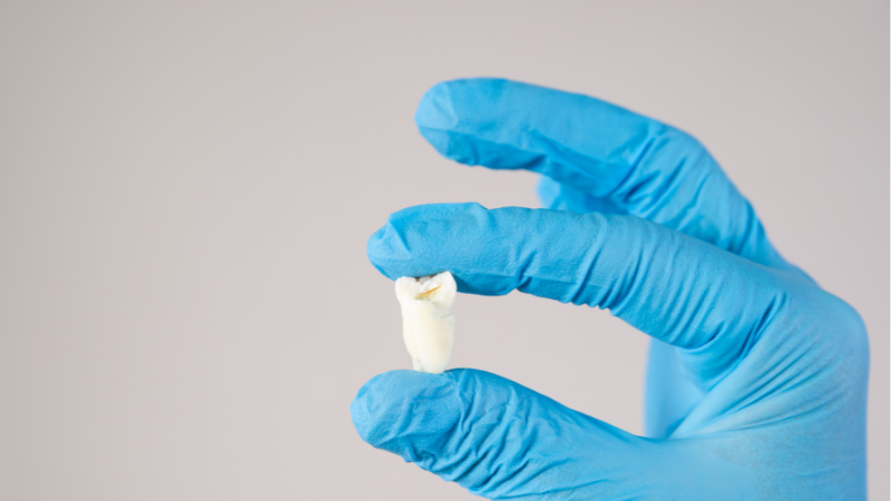 wisdom tooth extraction aftercare do’s and don’ts